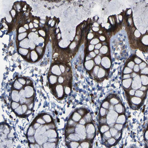 Immunohistochemical staining of human rectum shows strong cytoplasmic positivity in glandular cells.