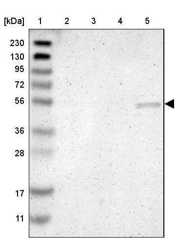 Lane 1: Marker [kDa] 230, 130, 95, 72, 56, 36, 28, 17, 11<br/>Lane 2: Human cell line RT-4<br/>Lane 3: Human cell line U-251MG sp<br/>Lane 4: Human plasma (IgG/HSA depleted)<br/>Lane 5: Human liver tissue