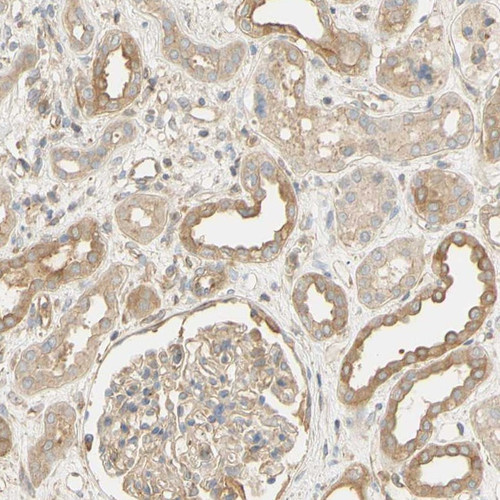 Immunohistochemical staining of human kidney shows moderate cytoplasmic positivity in cells in tubules.