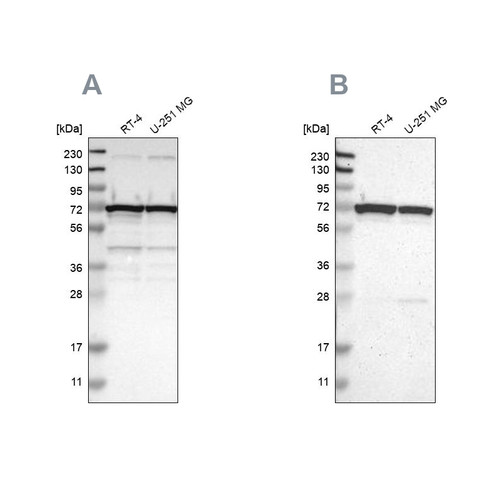 Western blot analysis using Anti-LRRC47 antibody HPA012018 (A) shows similar pattern to independent antibody HPA008512 (B).
