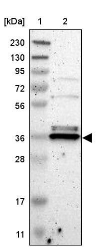 Lane 1: Marker [kDa] 230, 130, 95, 72, 56, 36, 28, 17, 11<br/>Lane 2: Human cell line RT-4