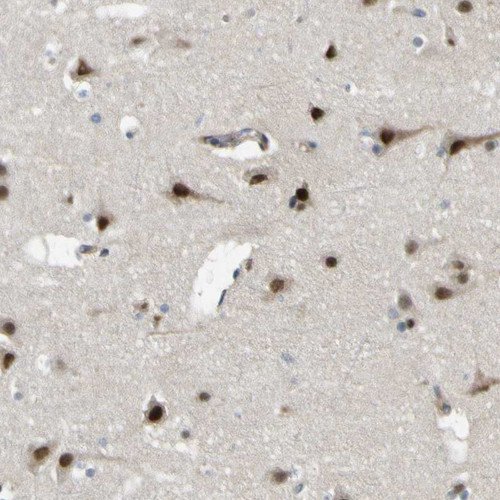 Immunohistochemical staining of human cerebral cortex shows strong nuclear positivity in neuronal cells.
