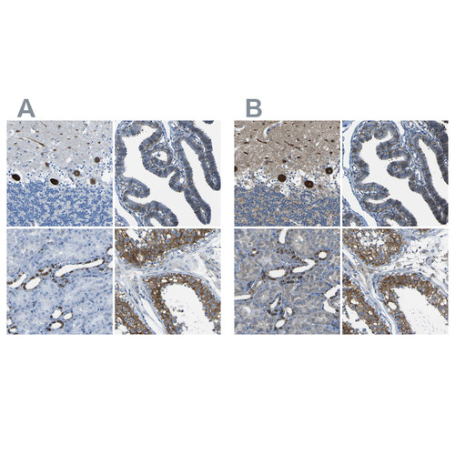Immunohistochemical staining of human cerebellum, fallopian tube, kidney and testis using Anti-STIM1 antibody HPA012123 (A) shows similar protein distribution across tissues to independent antibody HPA011088 (B).