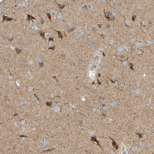 Immunohistochemical staining of human cerebral cortex shows strong cytoplasmic positivity in neurons.