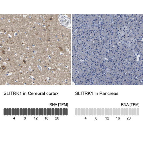 Immunohistochemistry analysis in human cerebral cortex and pancreas tissues using Anti-SLITRK1 antibody. Corresponding SLITRK1 RNA-seq data are presented for the same tissues.