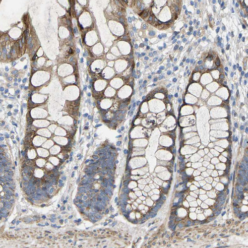 Immunohistochemical staining of human lower rectum shows moderate cytoplasmic/ membranous positivity in glandular cells. Immunohistochemical staining of human lower rectum shows moderate cytoplasmic/ membranous positivity in glandular cells.