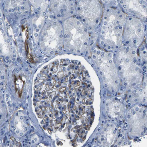 Immunohistochemical staining of human kidney shows moderate cytoplasmic positivity in cells in glomeruli.