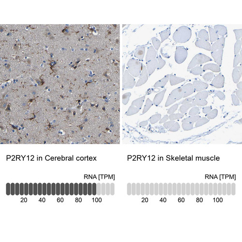 Immunohistochemistry analysis in human cerebral cortex and skeletal muscle tissues using HPA013796 antibody. Corresponding P2RY12 RNA-seq data are presented for the same tissues.