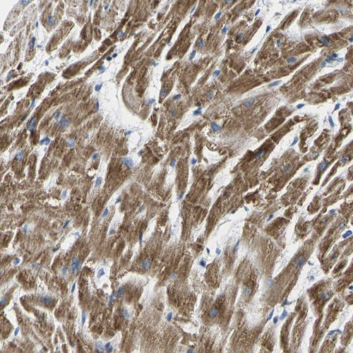 Immunohistochemical staining of human heart muscle shows strong cytoplasmic positivity in myocytes.