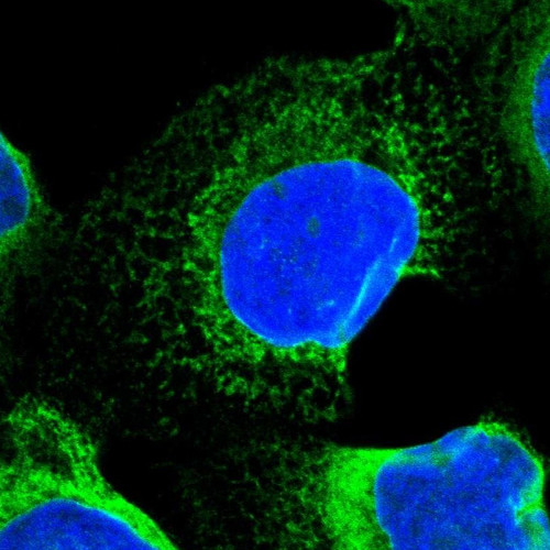 Immunofluorescent staining of human cell line A-431 shows positivity in endoplasmic reticulum.