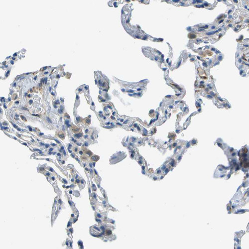 Immunohistochemical staining of human lung shows weak granular cytoplasmic positivity in macrophages.