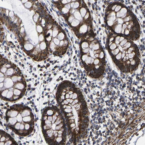 Immunohistochemical staining of human rectum shows strong granular cytoplasmic positivity in glandular cells.