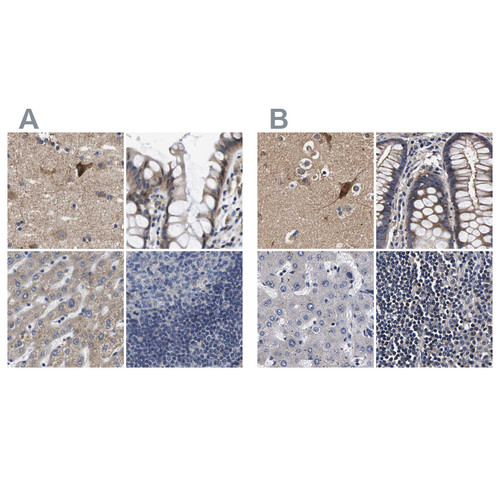 Immunohistochemical staining of human cerebral cortex, colon, liver and lymph node using Anti-MARCH7 antibody HPA014275 (A) shows similar protein distribution across tissues to independent antibody HPA022152 (B).