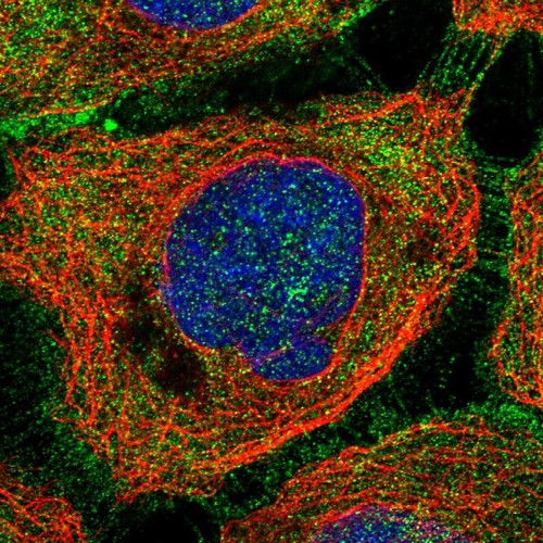 Immunofluorescent staining of human cell line A-431 shows localization to plasma membrane & cytosol.