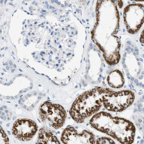 Immunohistochemical staining of human kidney shows strong granular cytoplasmic positivity in cells in tubules.