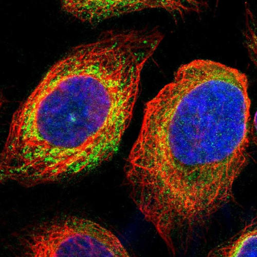 Immunofluorescent staining of human cell line A-431 shows localization to endoplasmic reticulum.