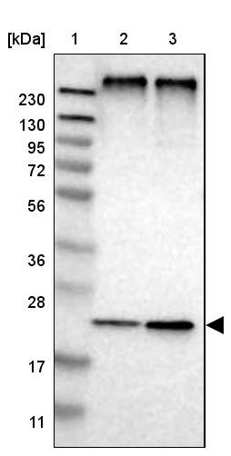 Lane 1: Marker [kDa] 230, 130, 95, 72, 56, 36, 28, 17, 11<br/>Lane 2: Human cell line RT-4<br/>Lane 3: Human cell line U-251MG sp