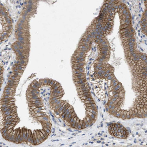 Immunohistochemical staining of human gallbladder shows moderate membranous positivity in glandular cells.
