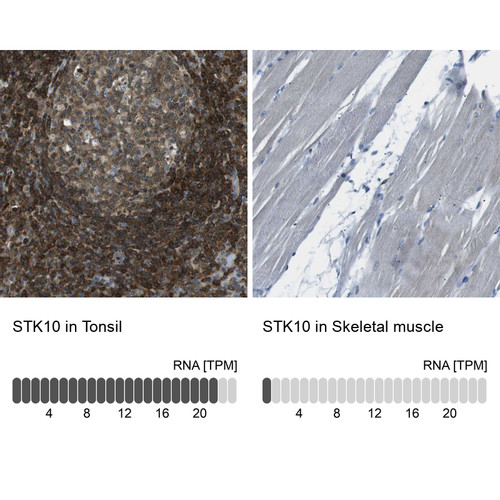 Immunohistochemistry analysis in human tonsil and skeletal muscle tissues using HPA015083 antibody. Corresponding STK10 RNA-seq data are presented for the same tissues.
