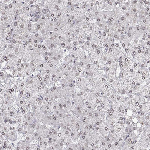 Immunohistochemical staining of human liver shows moderate nuclear membranous positivity in hepatocytes.