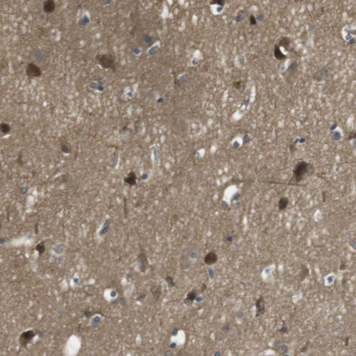 Immunohistochemical staining of human cerebral cortex shows moderate cytoplasmic positivity in neuronal cells.