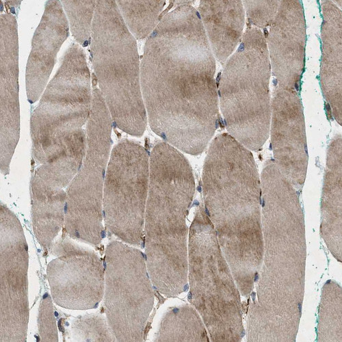 Immunohistochemical staining of human skeletal muscle strong granular cytoplasmic positivity in myocytes.