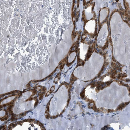 Immunohistochemical staining of human thyroid gland shows cytoplasmic positivity in glandular cells.