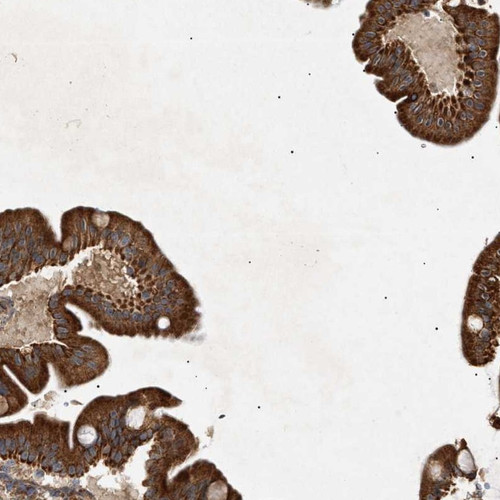 Immunohistochemical staining of human duodenum shows cytoplasmic positivity in glandular cells.