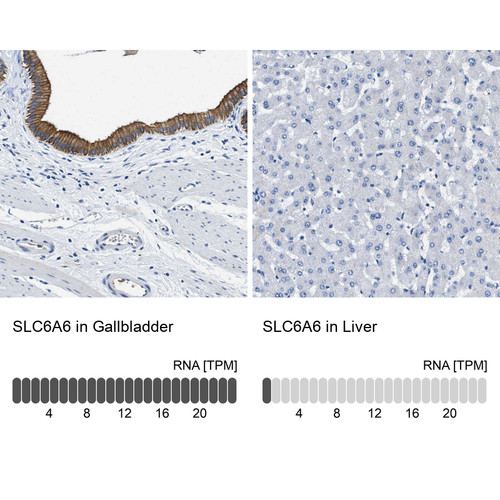 Immunohistochemistry analysis in human gallbladder and liver tissues using HPA016488 antibody. Corresponding SLC6A6 RNA-seq data are presented for the same tissues.