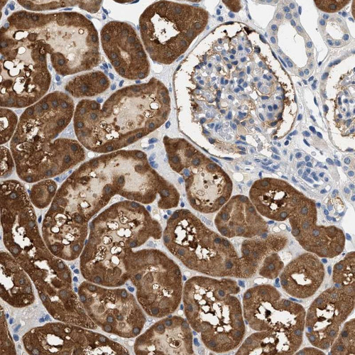 Immunohistochemical staining of human kidney shows cytoplasmic positivity in cells in tubules.