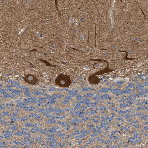 Immunohistochemical staining of human cerebellum shows strong cytoplasmic positivity in Purkinje cells.