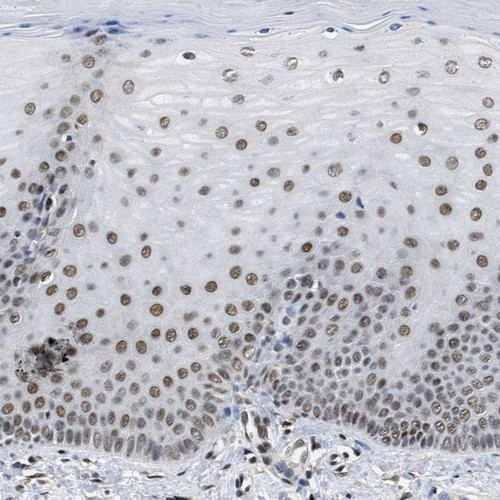 Immunohistochemical staining of human cervix, uterine shows moderate nuclear positivity in squamous epithelial cells.