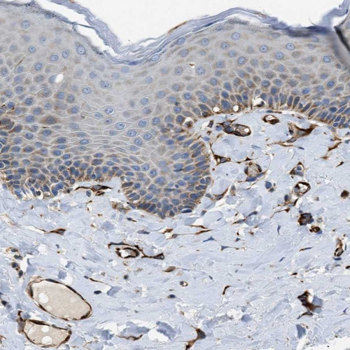 Immunohistochemical staining of human vulva/anal skin shows distinct positivity in blood vessels.