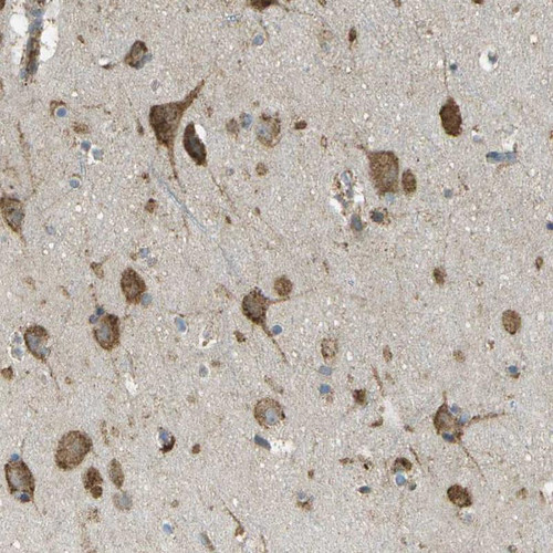 Immunohistochemical staining of human cerebral cortex shows strong cytoplasmic positivity in neurons.