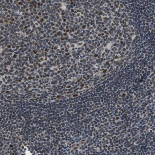 Immunohistochemical staining of human tonsil shows nuclear positivity in germinal and non germinal center.