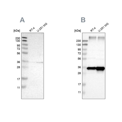 Western blot analysis using Anti-SSR1 antibody HPA017062 (A) shows similar pattern to independent antibody HPA011276 (B).