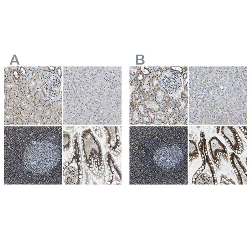 Immunohistochemical staining of human kidney, liver, lymph node and small intestine using Anti-SP100 antibody HPA017384 (A) shows similar protein distribution across tissues to independent antibody HPA016707 (B).