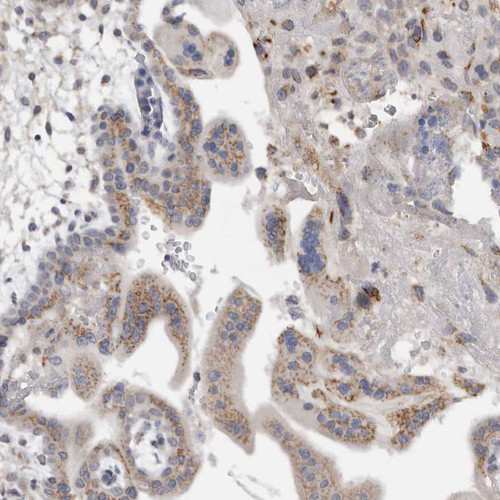 Immunohistochemical staining of human placenta shows moderate granular cytoplasmic positivity in trophoblastic cells.