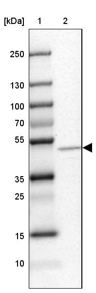 Lane 1: Marker [kDa] 250, 130, 100, 70, 55, 35, 25, 15, 10<br/>Lane 2: Human cell line SK-MEL-30