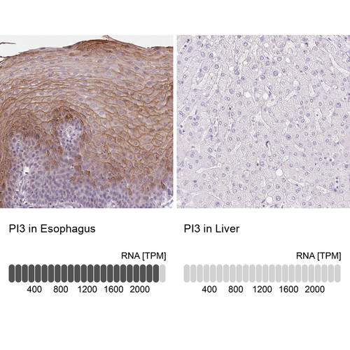 Immunohistochemistry analysis in human esophagus and liver tissues using HPA017737 antibody. Corresponding PI3 RNA-seq data are presented for the same tissues.