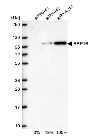 Western blot analysis in U2OS cells transfected with control siRNA, target specific siRNA probe #1 and #2, using Anti-RRP1B antibody. Remaining relative intensity is presented.