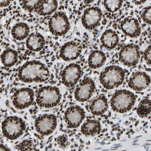 Immunohistochemical staining of human small intestine shows strong nuclear positivity in glandular cells.