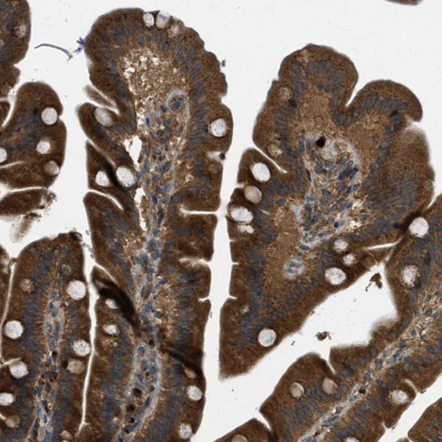 Immunohistochemical staining of human duodenum shows strong cytoplasmic positivity in glandular cells.
