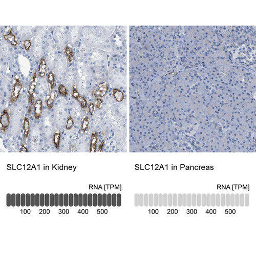 Immunohistochemistry analysis in human kidney and pancreas tissues using HPA018107 antibody. Corresponding SLC12A1 RNA-seq data are presented for the same tissues.