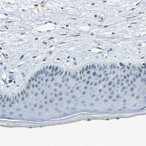 Immunohistochemical staining of human skin shows weak positivity in nucleoli in squamous epithelial cells.