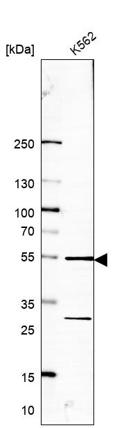 Western blot analysis in human cell line K562.