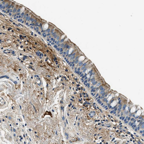 Immunohistochemical staining of human bronchus shows moderate cytoplasmic and membranous positivity in respiratory epithelial cells.