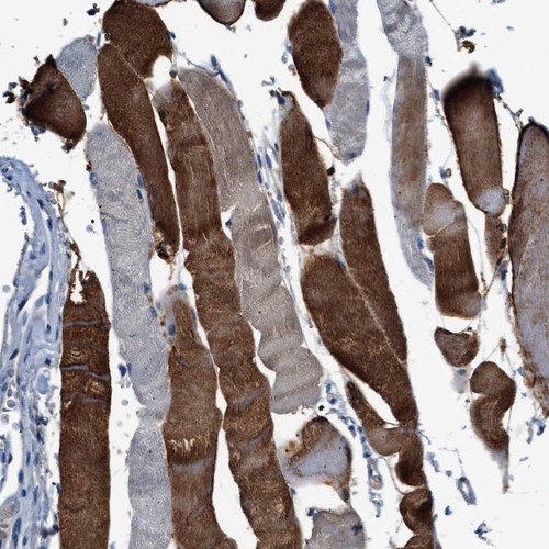 Immunohistochemical staining of human skeletal muscle shows strong cytoplasmic positivity in a heterogeneous staining pattern.