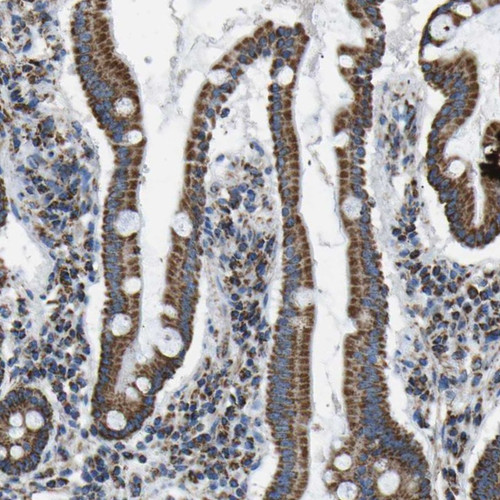 Immunohistochemical staining of human duodenum shows strong cytoplasmic positivity in glandular cells.
