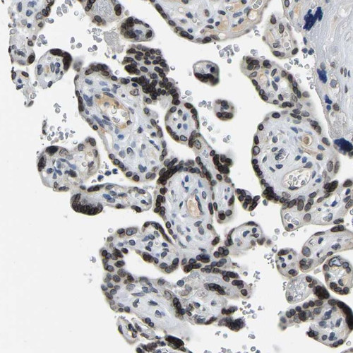 Immunohistochemical staining of human placenta shows strong nuclear membrane positivity in trophoblastic cells.